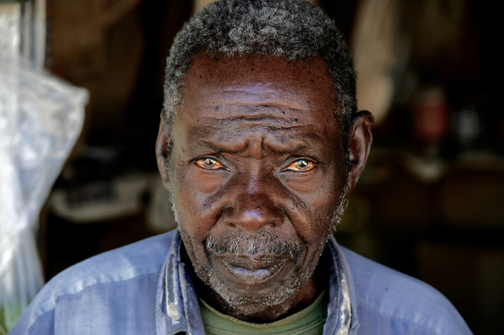A health worker carrying out a diagnostic test in the field